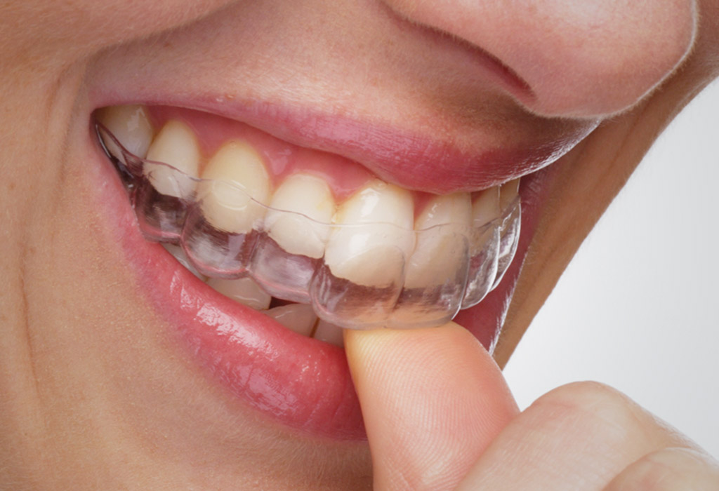 Ortodoncia en Clínica Dental Medent